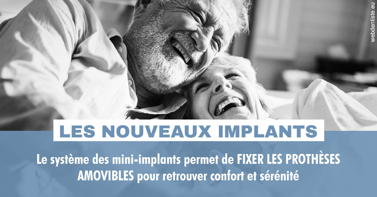 https://dr-marianne-paganon.chirurgiens-dentistes.fr/Les nouveaux implants 2