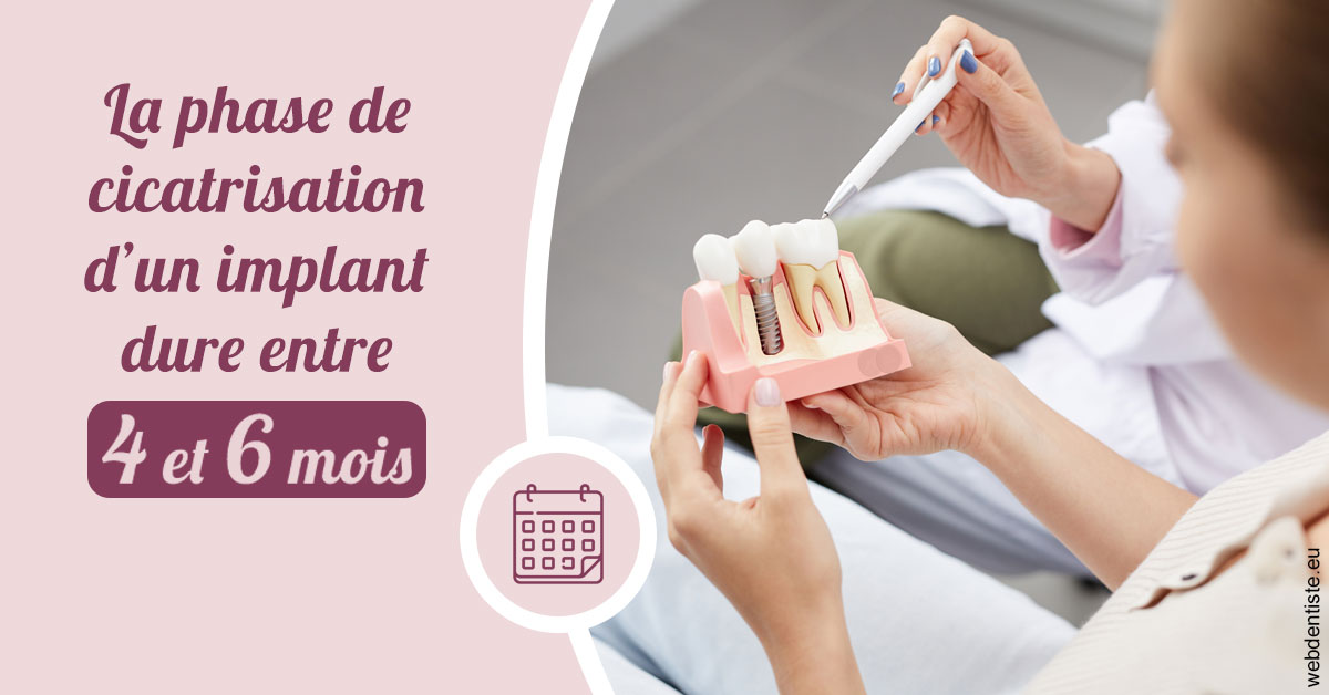 https://dr-marianne-paganon.chirurgiens-dentistes.fr/Cicatrisation implant 2
