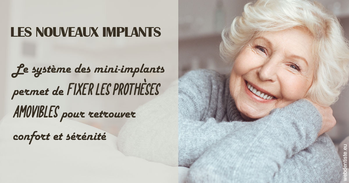 https://dr-marianne-paganon.chirurgiens-dentistes.fr/Les nouveaux implants 1