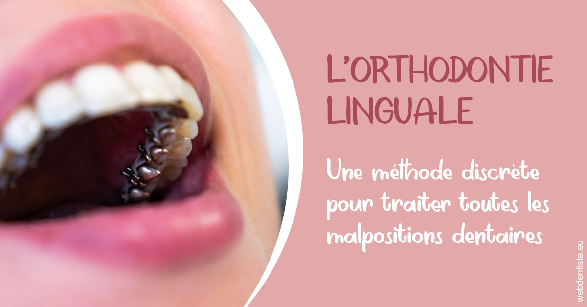 https://dr-marianne-paganon.chirurgiens-dentistes.fr/L'orthodontie linguale 2
