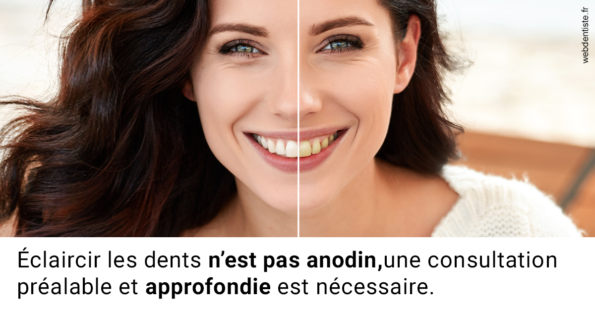 https://dr-marianne-paganon.chirurgiens-dentistes.fr/Le blanchiment 2