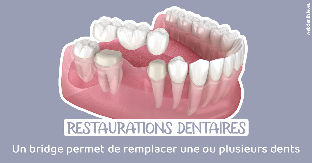 https://dr-marianne-paganon.chirurgiens-dentistes.fr/Bridge remplacer dents 1