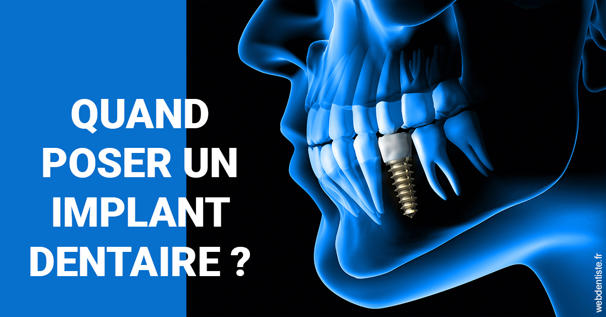 https://dr-marianne-paganon.chirurgiens-dentistes.fr/Les implants 1