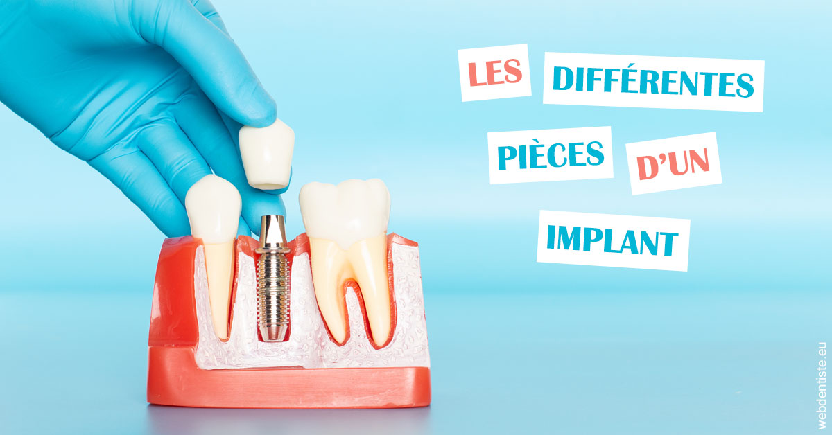 https://dr-marianne-paganon.chirurgiens-dentistes.fr/Les différentes pièces d’un implant 2