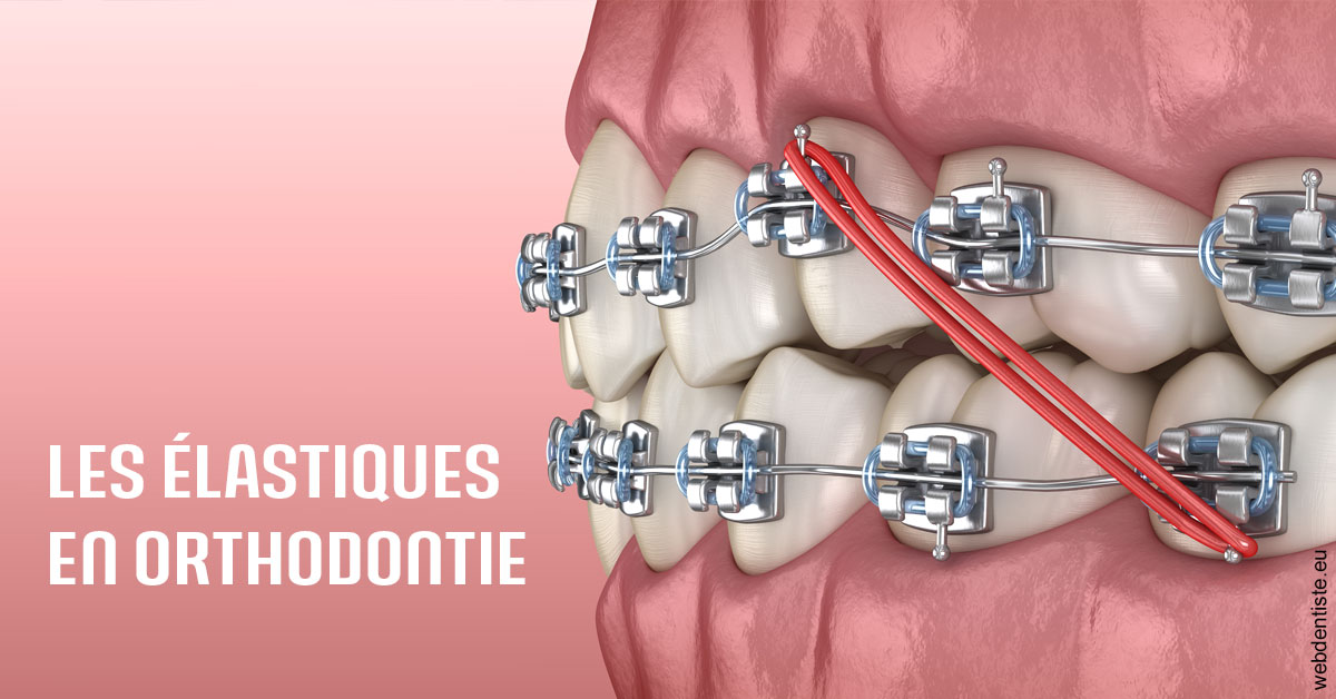 https://dr-marianne-paganon.chirurgiens-dentistes.fr/Elastiques orthodontie 2