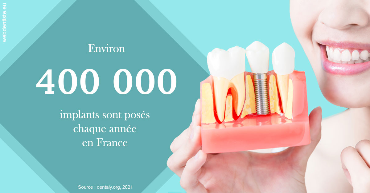 https://dr-marianne-paganon.chirurgiens-dentistes.fr/Pose d'implants en France 2